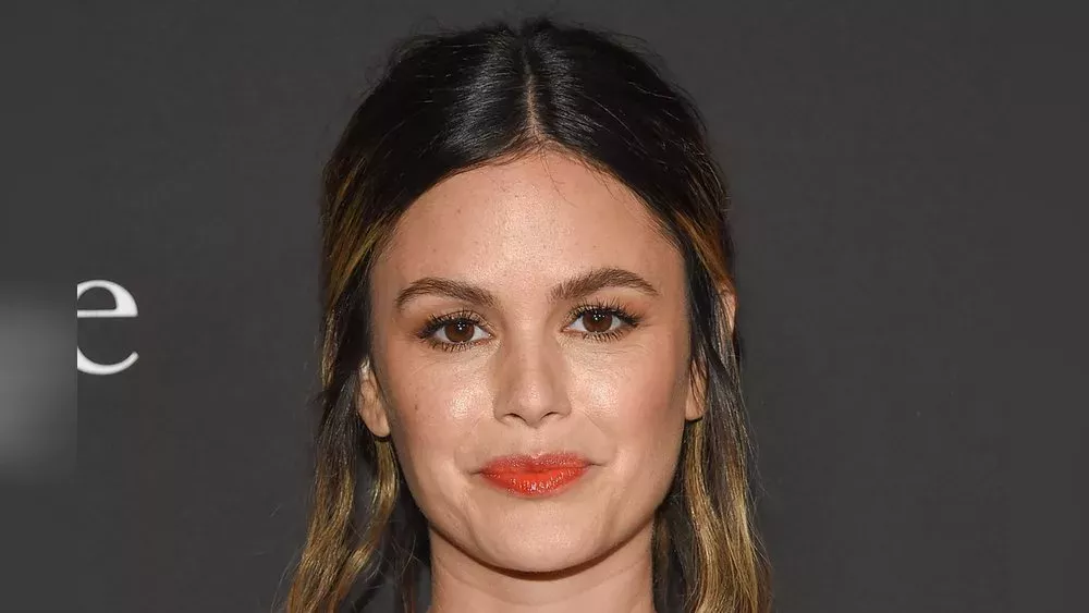 Rachel Bilson: Die Schauspielerin spricht über dunkle Zeit ihres Lebens