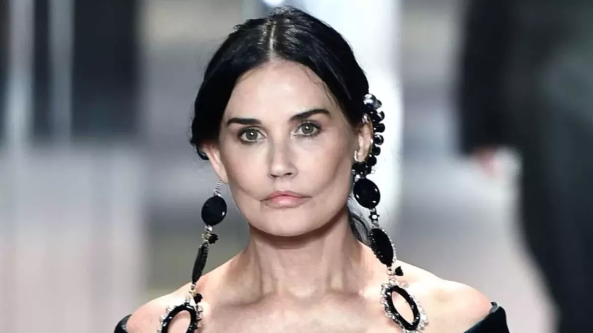7 Weltstars vor und nach ihren Beauty-Operationen 