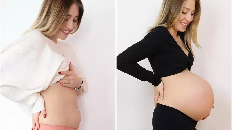 Bibi's Beauty Palace: Große Sorge um schwangere Influencerin