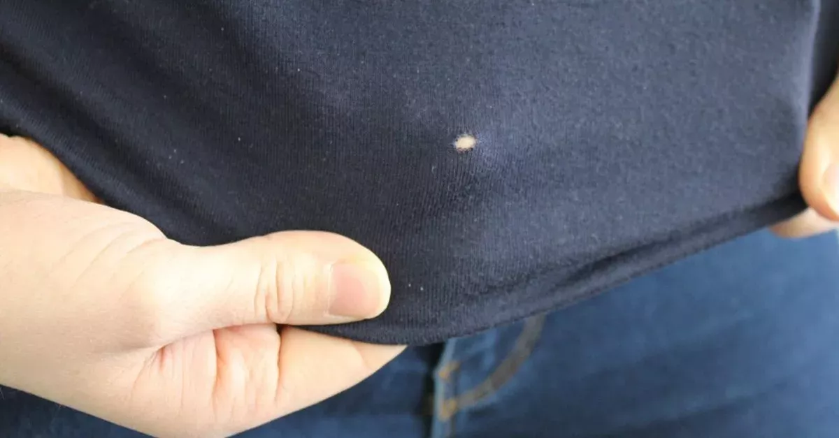 Löcher im T-Shirt: Das ist der Grund