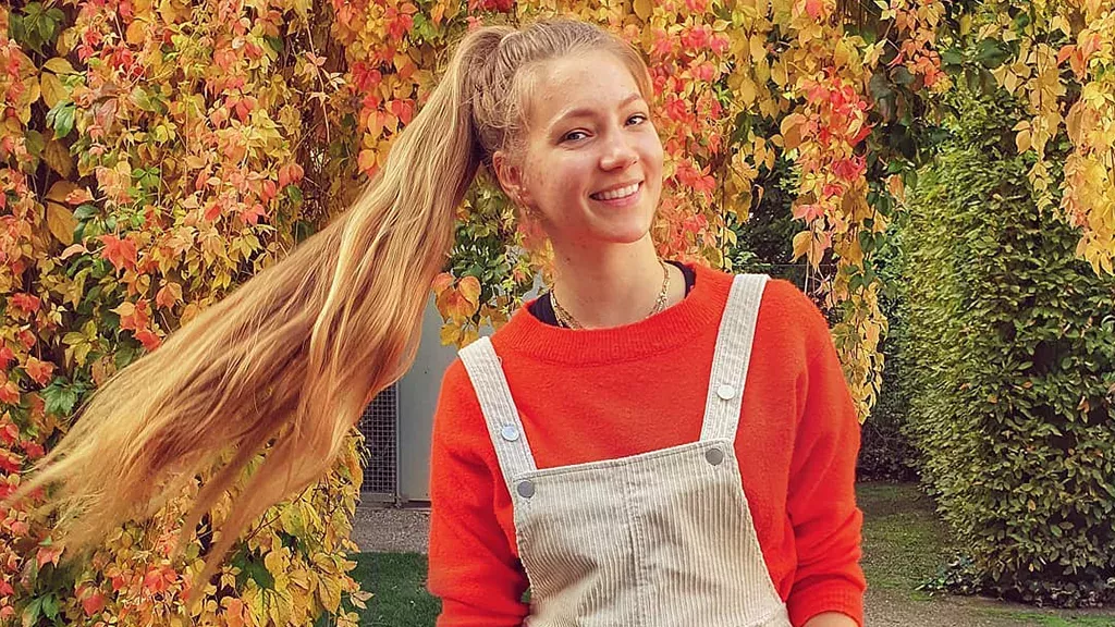 Hanna Bohnekamp versteckt ihre Akne nicht