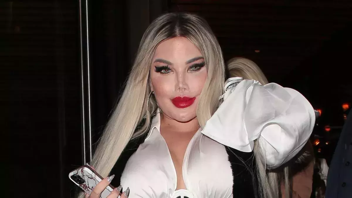 Jessica Alves will sich weiteren Beauty-OPs unterziehen