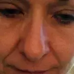 Sie schminkt sich 25 Jahre lang nicht ab. Dann geht sie zum Arzt und bekommt die Diagnose!