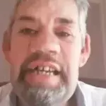 Wie im Alptraum: Bauer Uwe verliert alle Zähne!