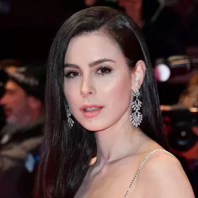Lena Meyer-Landrut bei Reitunfall schwer verletzt