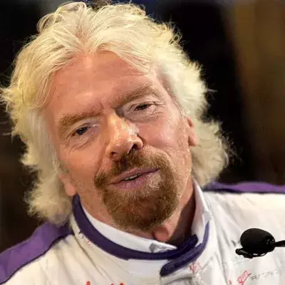 Schwerer Fahrradsturz: Richard Branson zeigt seine Verletzungen