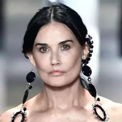 7 Weltstars vor und nach ihren Beauty-Operationen 