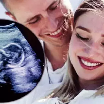 Babyboom: Diese deutschen YouTuberinnen sind jetzt schwanger!