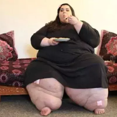 Nach einer OP nimmt diese junge Frau 180 Kilo ab. Sie ist nicht mehr wieder zu erkennen!
