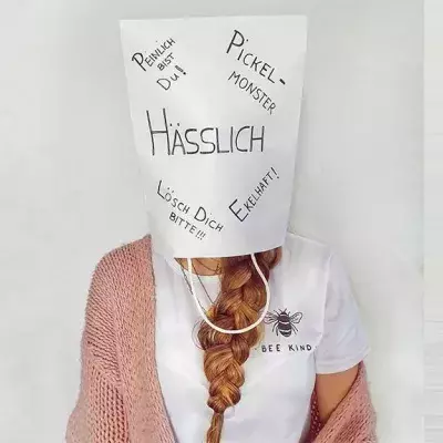 Hanna Bohnekamp steht zu ihrer Akne