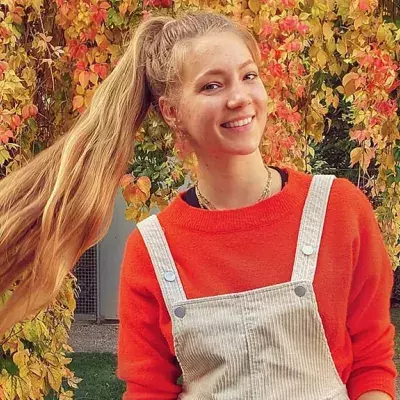 Hanna Bohnekamp versteckt ihre Akne nicht