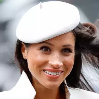 Meghan Markle-Operation für 30.000 Dollar