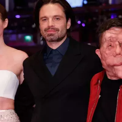 Entstellter Berlinale-Star Adam Pearson begeistert bei Premiere