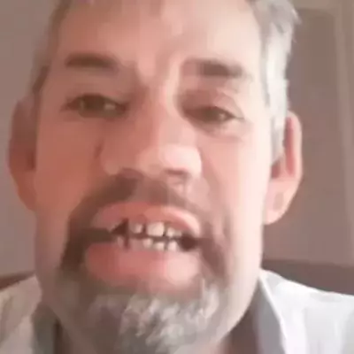 Wie im Alptraum: Bauer Uwe verliert alle Zähne!